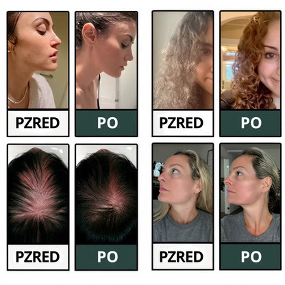 HYDROLUXE™ – Usuwa chlor i kamień z Twojego prysznica