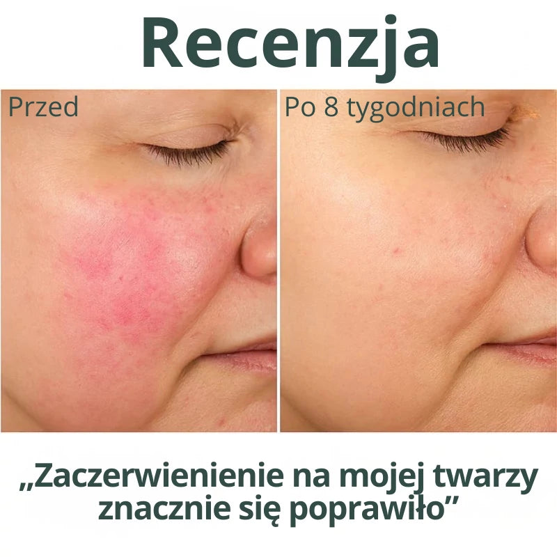 HYDROLUXE™ – Usuwa chlor i kamień z Twojego prysznica