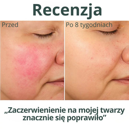 HYDROLUXE™ – Usuwa chlor i kamień z Twojego prysznica